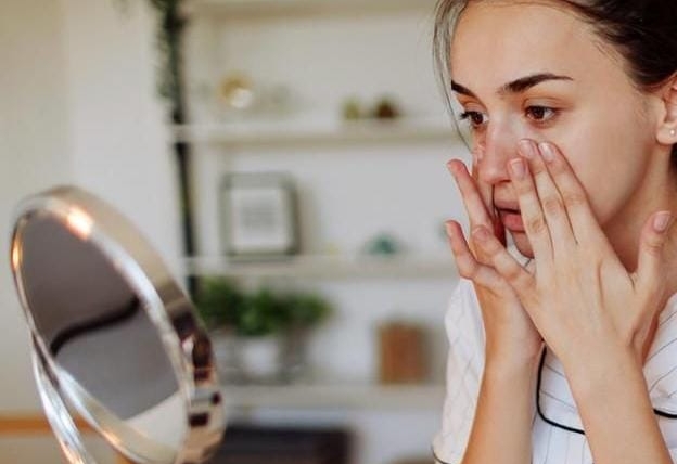 Baca.today-10 Cara Mengatasi Kulit Kering dan Kusam Selama Berpuasa