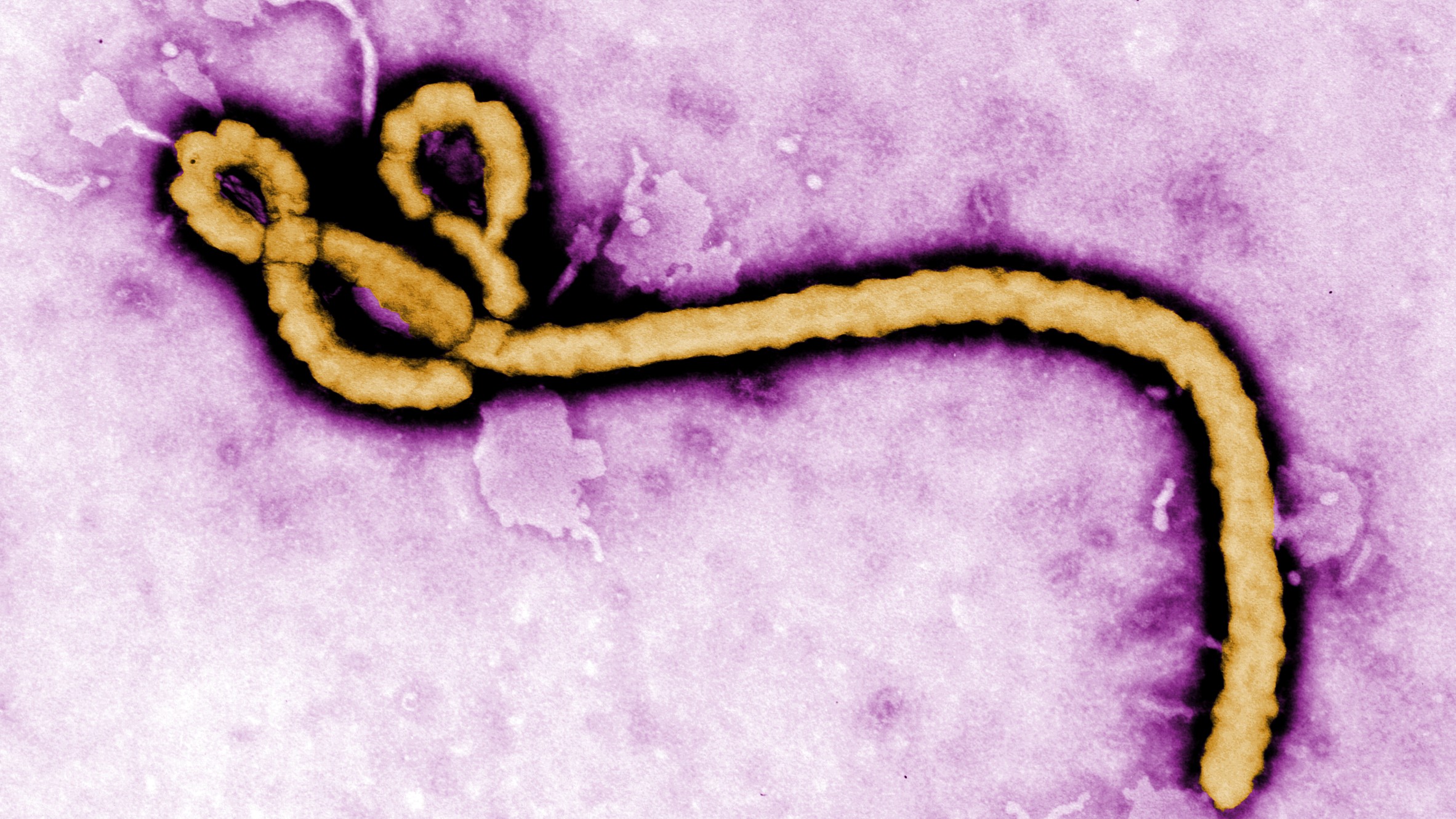 Baca.today_Ebola Kembali Meningkat: Penyebab, Gejala dan Langkah Pencegahannya