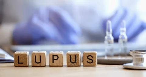 Baca.today-Lupus: Penyakit Autoimun yang Dapat Menyerang Berbagai Organ Tubuh